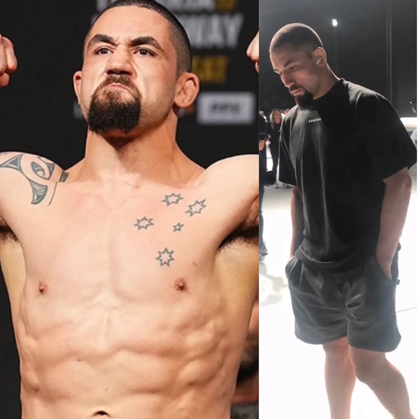 image_67467685a645b A Knockout Smile: Robert Whittaker’s Fight Against Dental Drama from UFC 308