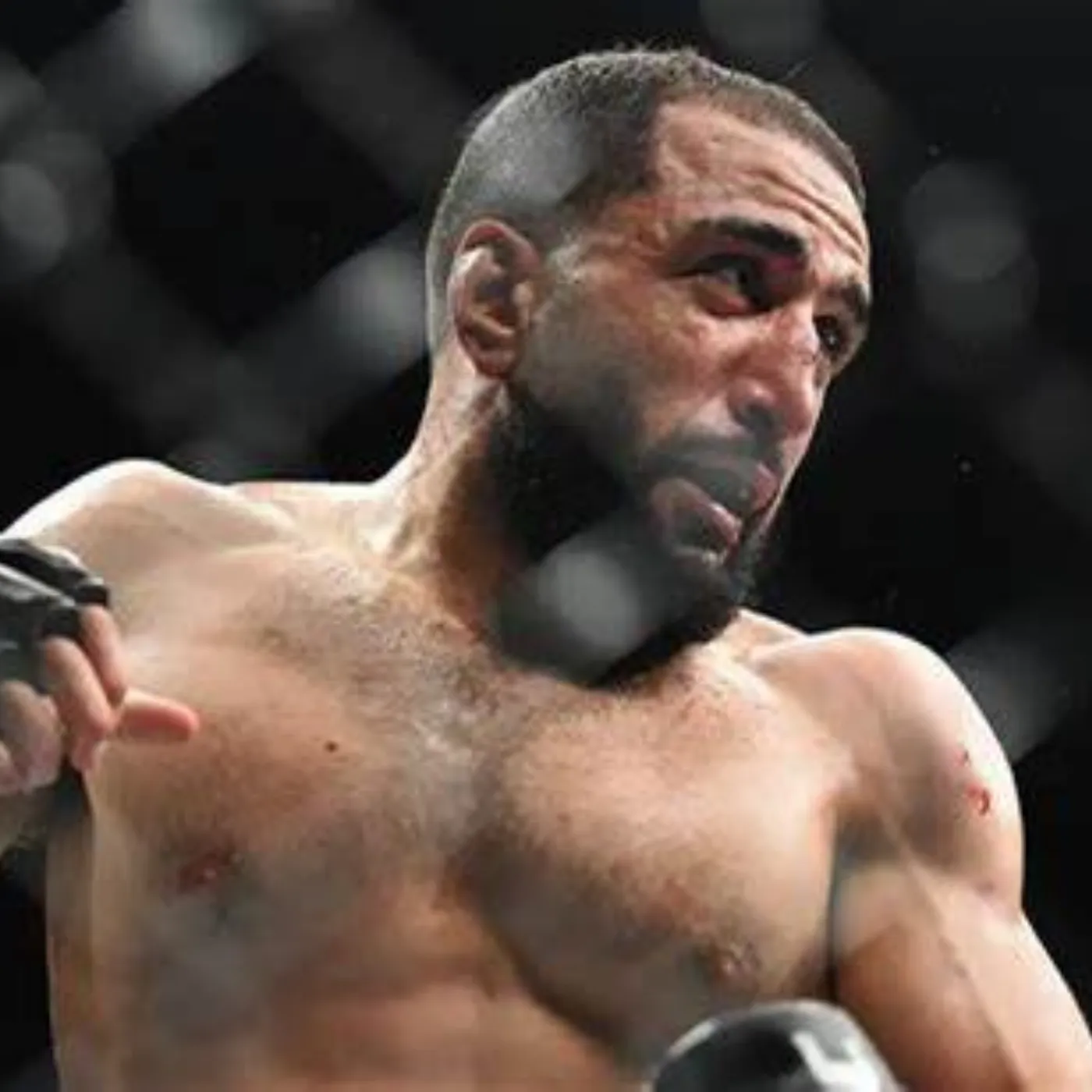 image_674e679d2cde2 From Welterweight to Woundedweight: How a Foot Infection Kicked Belal Muhammad Out of the UFC Finale