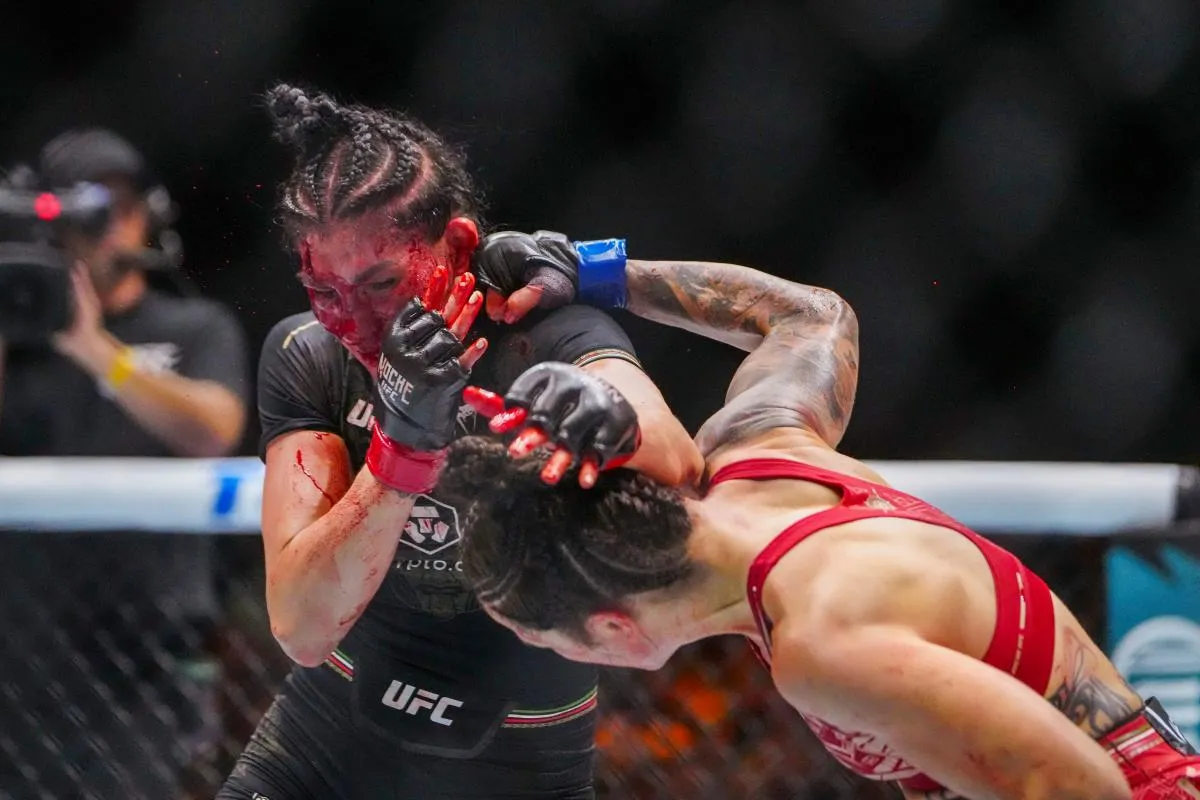 image_67501bc194e49 Irene Aldana’s miraculous recovery from UFC 306 facial injuries