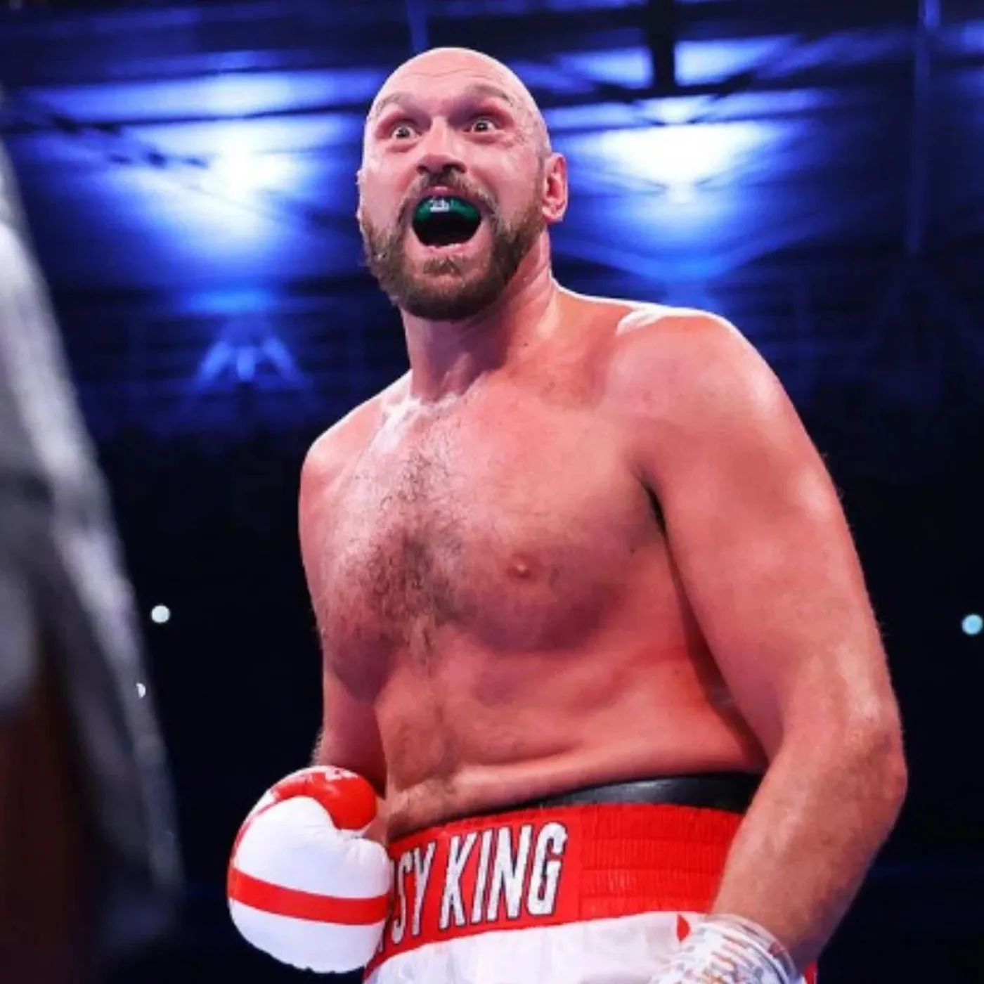 image_677226cbb9890 Tyson Fury Must Be Broken to Rise Again as Heavyweight Champion